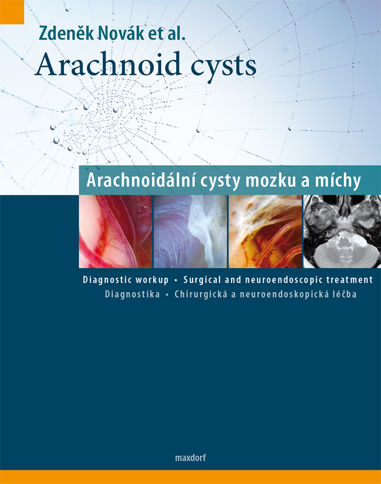 Arachnoid Cysts/ Arachnoidální cysty mozku a míchy